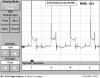 190e running rich with eha on/off.Bad mpg.Help!-vw-3cyl.jpg